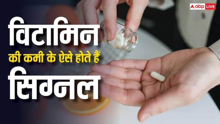 These symptoms are seen in body due to lack of vitamins विटामिन की कमी होने पर शरीर में दिखते हैं लक्षण, भूलकर भी न करें नजरअंदाज