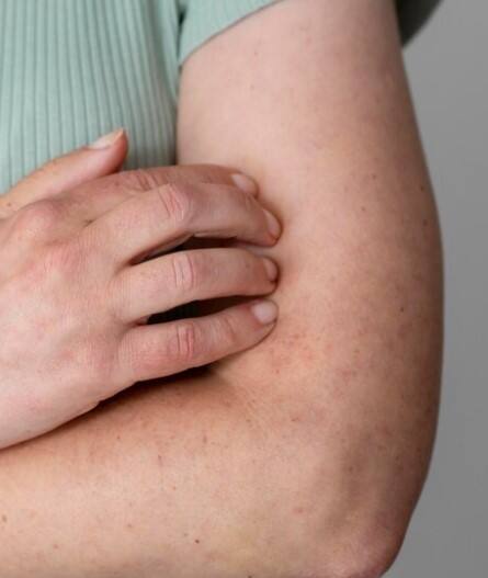 ਗਰਮੀਆਂ ‘ਚ ਫੰਗਲ ਇੰਫੈਕਸ਼ਨ ਤੋਂ ਕਿਵੇਂ ਕਰੀਏ ਬਚਾਅ, ਜਾਣੋ ਸਿਹਤ ਮਾਹਿਰ ਤੋਂ