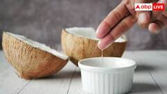 ਗਰਮੀਆਂ ‘ਚ ਸਰੀਰ 'ਤੇ ਕਿਹੜਾ ਤੇਲ ਲਗਾਉਣਾ ਸਹੀ ? ਜ਼ਿਆਦਾਤਰ ਲੋਕ ਨਹੀਂ ਜਾਣਦੇ ਸਹੀ ਜਵਾਬ