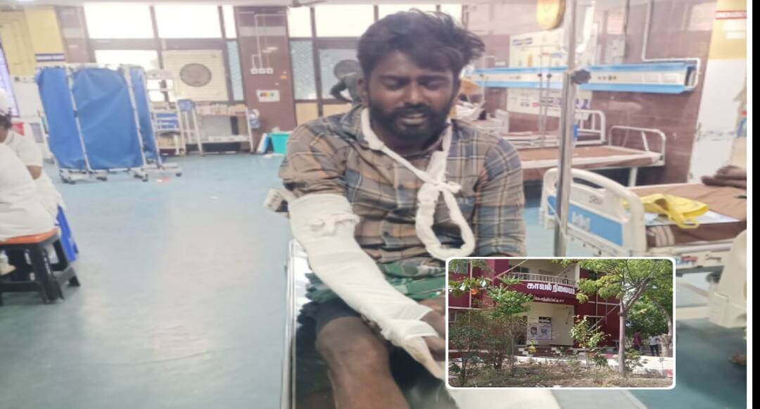 madurai sathirapatti Police station looted culprit broke his arm and leg while fleeing tnn மதுரையில் காவல்நிலையத்தை சூறையாடிய சம்பவம்.. தப்பி ஓடியபோது குற்றவாளி கை, கால் முறிவு !