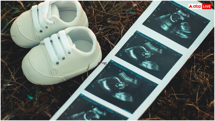 इसके अलावा अल्ट्रासाउंड स्कैन से गर्भाशय में भ्रूण की थैली (gestational sac) को देखने के लिए आमतौर पर 4-5 सप्ताह का वक्त लगता है. यह प्रक्रिया प्रेग्नेंसी की पुष्टि करने और भ्रूण की स्थिति जांचने का सबसे विश्वसनीय तरीका है. हालांकि, शुरुआती चरण में यह कम उपयोगी होता है, क्योंकि इतनी जल्दी भ्रूण का डिवेलपमेंट पूरी तरह नजर नहीं आता है.