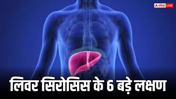 टीवी एक्ट्रेस सना मकबूल को लिवर सिरोसिस हो गया है. वह बिना ट्रांसप्लांट कराए इस बीमारी से निजात पाने की कोशिश में लगी हुई हैं. आइए आपको इस बीमारी के बारे में बताते हैं.