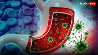 इस राज्य में फैल गया हैजा! अब तक 5 मरीजों की मौत; 1500 से ज्यादा संक्रमित