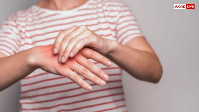 eating yellow vegetables control uric acid reduce pain and swelling पीले रंग की सब्जी खाने से यूरिक एसिड होगा कंट्रोल, दर्द और सूजन की परेशानी भी होगी कम