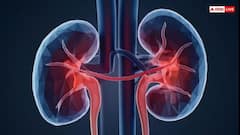 आंखों के इन बदलावों को न करें नजरअंदाज, किडनी में हो सकती है गंभीर समस्या