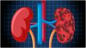 Kidney Health : కిడ్నీని ఆరోగ్యంగా ఉంచే అలవాట్లు ఇవే.. మూత్రపిండాల్లో రాళ్లు రాకుండా ఇవి హెల్ప్ చేస్తాయట