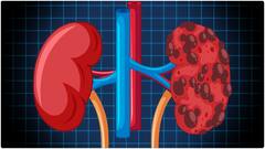 Kidney Health : కిడ్నీని ఆరోగ్యంగా ఉంచే అలవాట్లు ఇవే.. మూత్రపిండాల్లో రాళ్లు రాకుండా ఇవి హెల్ప్ చేస్తాయట