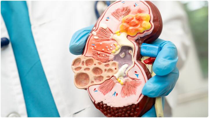 బ్యాలెన్స్డ్ డైట్ కిడ్నీల ఆరోగ్యాన్ని కాపాడుతుంది. కాబట్టి పండ్లు, కూరగాయలు, మల్టీగ్రెయిన్స్, సోడియం తక్కువగా ఉండే పుడ్స్ రోజూ తీసుకోవాలి. సాల్ట్ ఎక్కువగా ఉండే ఫుడ్స్ తీసుకోకూడదు. ఇవి కిడ్నీలపై ఎక్కువ భారం వేస్తాయి.