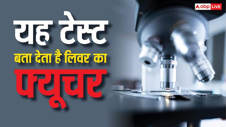 लिवर का ये एक टेस्ट बता देगा आपका भविष्य, पता चल जाएगा कब आ सकता है हार्ट अटैक