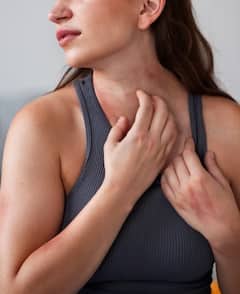 ਗਰਮੀ ਕਾਰਨ ਪਿੱਠ 'ਤੇ ਹੋਈ ਪਿੱਤ ਤੋਂ ਮਿਲੇਗਾ ਛੁਟਕਾਰਾ, ਬਸ ਅਪਲਾਈ ਕਰੋ ਇਹ ਘਰੇਲੂ ਨੁਸਖੇ