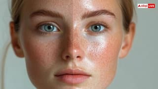 बरसात में स्किन होने लगती है ऑयली, मिनटों में खत्म करने के लिए अपनाएं ये उपाय