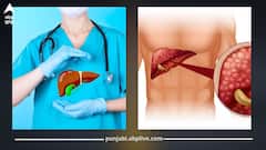 ਜਿਗਰ 'ਚ ਪਾਣੀ ਭਰਨ ਦੇ ਖਤਰਨਾਕ ਲੱਛਣ – ਸਾਵਧਾਨ ਰਹੋ! ਸਮੇਂ ਰਹਿੰਦੇ ਕਰਵਾਓ ਇਲਾਜ