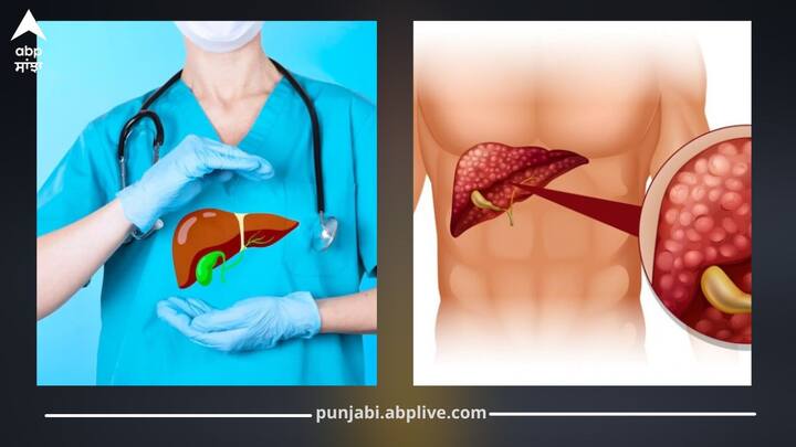 ਜਿਗਰ ਸਾਡੀ ਸਰੀਰ ਦੀ ਇੱਕ ਮਹੱਤਵਪੂਰਣ ਅੰਗ ਹੈ ਜੋ ਖੂਨ ਸਾਫ਼ ਕਰਨ ਅਤੇ ਪਾਚਣ ਤੰਤਰ ਨੂੰ ਠੀਕ ਰੱਖਣ ਵਿੱਚ ਮਦਦ ਕਰਦਾ ਹੈ। ਜੇਕਰ ਇਸ ਵਿੱਚ ਕੋਈ ਗੜਬੜ ਆ ਜਾਵੇ ਤਾਂ ਸਰੀਰ ਦੀ ਸਾਰੀ ਕਾਰਗੁਜ਼ਾਰੀ ਪ੍ਰਭਾਵਿਤ ਹੋ ਸਕਦੀ ਹੈ।