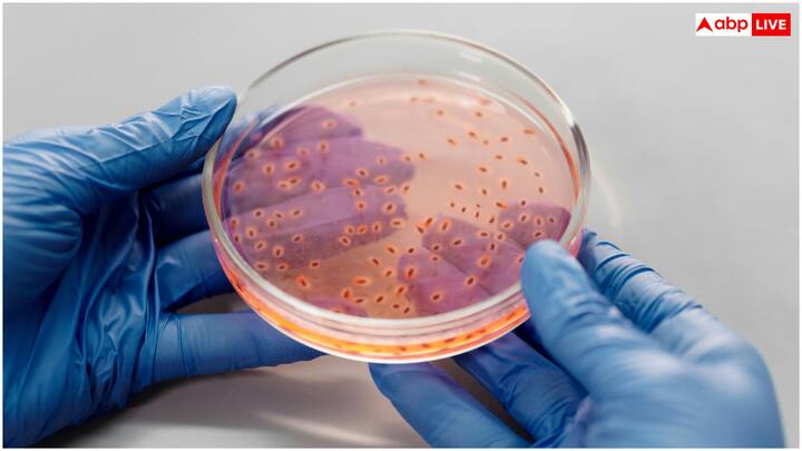 कुछ आदतों जैसे टॉयलेट पेपर का गलत तरीके से इस्तेमाल, पर्याप्त मात्रा में पानी न पीना और पेशाब को ज्यादा देर तक रोककर रखने से भी यूरिन इंफेक्शन का खतरा बढ़ जाता है.