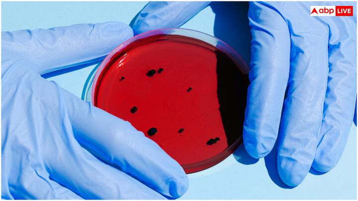 शारीरिक संबंध बनाते वक्त भी महिलाओं के यूरिन ट्रैक्ट में इंफेक्शन का खतरा रहता है. यूरिन इंफेक्शन शारीरिक संबंध से होने वाली बीमारी नहीं है, लेकिन यौन संबंध बनाने के दौरान इसके होने की आशंका बढ़ जाती है.