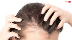 Hair Fall: बालों के झड़ने के लिए कौन से ग्रह जिम्मेदार होता है?