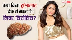 क्या बिना ट्रांसप्लांट ठीक हो सकता है सना मकबूल का लिवर सिरोसिस, ऐसा होना कितना पॉसिबल?