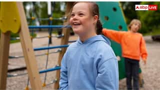 डाउन सिंड्रोम से पीड़ित बच्चों के कोच बने आमिर खान, जानिए कैसे जन्मजात होती है ये कंडीशन