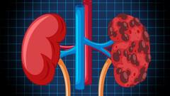 Kidney Transplant: কিডনি ট্রান্সপ্লান্টের আগে এই ৫ বিষয় খেয়াল রাখা জরুরি, অসতর্ক হলেই জীবন বিপন্ন হতে পারে