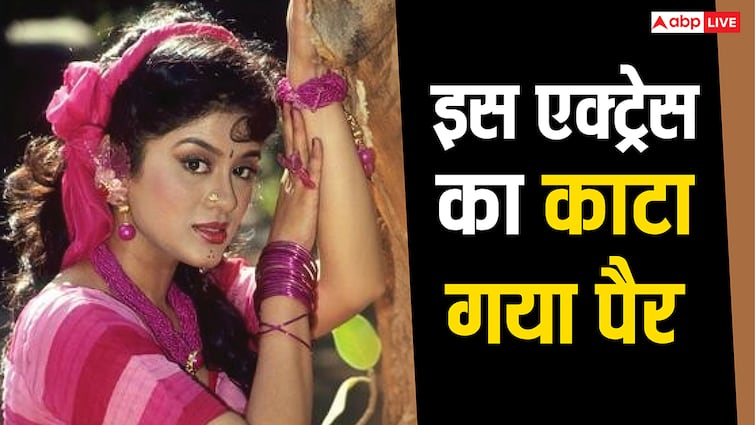 आखिर किस मजबूरी में नागिन की इस एक्ट्रेस का काटना पड़ा पैर, नहीं चाहती थी जीना
