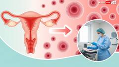 Cervical Cancer: Not Just HPV, Here’s How Lifestyle, Immunity and Inequity Play a Role