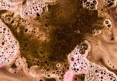 बरसात में क्यों बढ़ जाता है पेट दर्द? जानिए 6 कारण