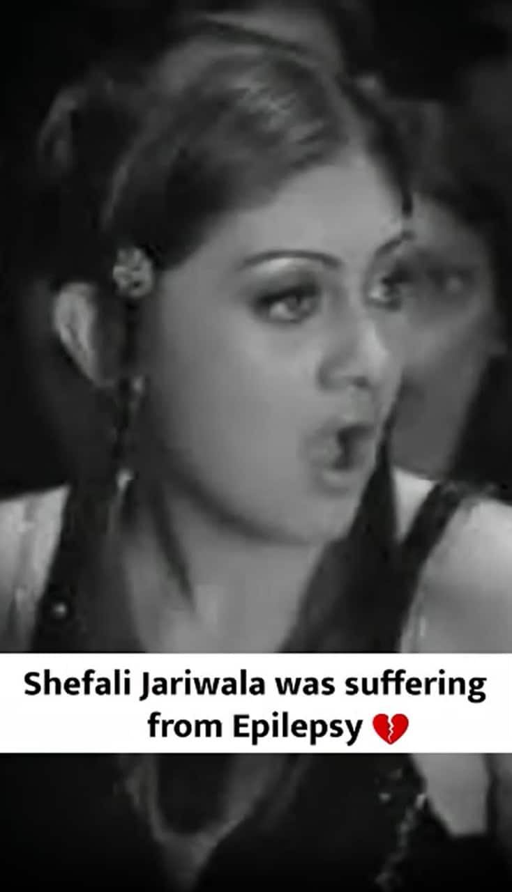 Shefali Jariwala’s Battle With Epilepsy, Kaanta Laga Girl Passes Away At 42