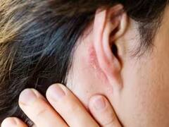 lifestyle: કાનમાં કેમ આવે છે ખંજવાળ? આ 6 કારણો જાણીને તમે ચોંકી જશો