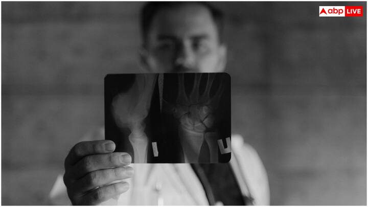 कैल्शियम और विटामिन डी, हड्डियों को मजबूत बनाने और ऑस्टियोपोरोसिस के खतरे को कम करने में मदद करता है. कैल्शियम डेयरी उत्पादों, हरी पत्तेदार सब्जियों और कुछ फलों में पाया जाता है, जबकि विटामिन डी सूर्य के प्रकाश, वसायुक्त मछली, अंडे की जर्दी और दूध-दही से मिलता है.