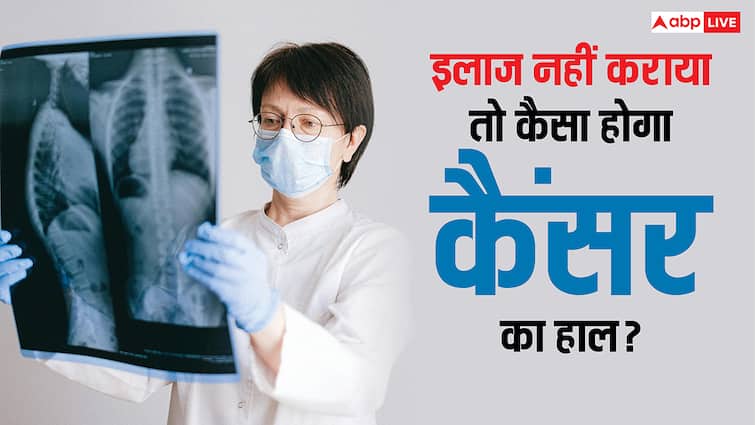 इलाज नहीं कराया तो कितनी तेजी से फैल सकता है कैंसर? हकीकत जान लेंगे तो कांप जाएगी रूह