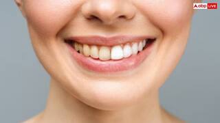 पीले दांत दूसरों के सामने ना कर दे शर्मिंदा, नमक से करें इसका मिनटों में इलाज