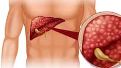 Liver Damage Symptoms: বিপদের মুখে লিভার, ড্যামেজ হওয়ার আগে কোনও লক্ষণ প্রকাশ পায় কি ?
