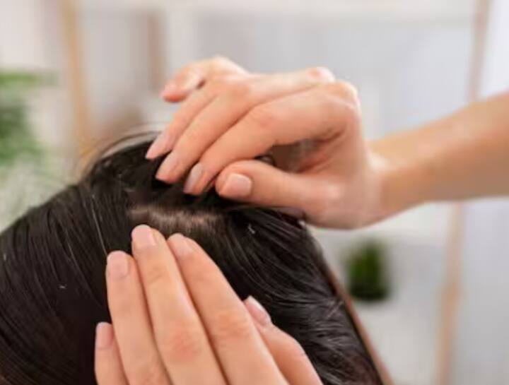 ਸਕੈਲਪ ਦੀ ਸਫਾਈ ਵੱਲ ਧਿਆਨ ਦਿਓ: ਹਫ਼ਤੇ ਵਿੱਚ ਘੱਟੋ-ਘੱਟ ਦੋ ਵਾਰ ਆਪਣੇ ਵਾਲਾਂ ਨੂੰ ਸ਼ੈਂਪੂ ਨਾਲ ਧੋਵੋ। ਮੀਂਹ ਵਿੱਚ, ਖੋਪੜੀ 'ਤੇ ਧੂੜ ਅਤੇ ਪਸੀਨਾ ਜਮ੍ਹਾ ਹੋ ਜਾਂਦਾ ਹੈ, ਜਿਸ ਨਾਲ ਵਾਲ ਕਮਜ਼ੋਰ ਹੋ ਜਾਂਦੇ ਹਨ ਅਤੇ ਝੜਨ ਲੱਗਦੇ ਹਨ।