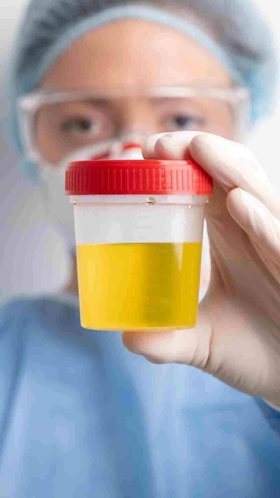 खुद की पेशाब पीना कितना खतरनाक?