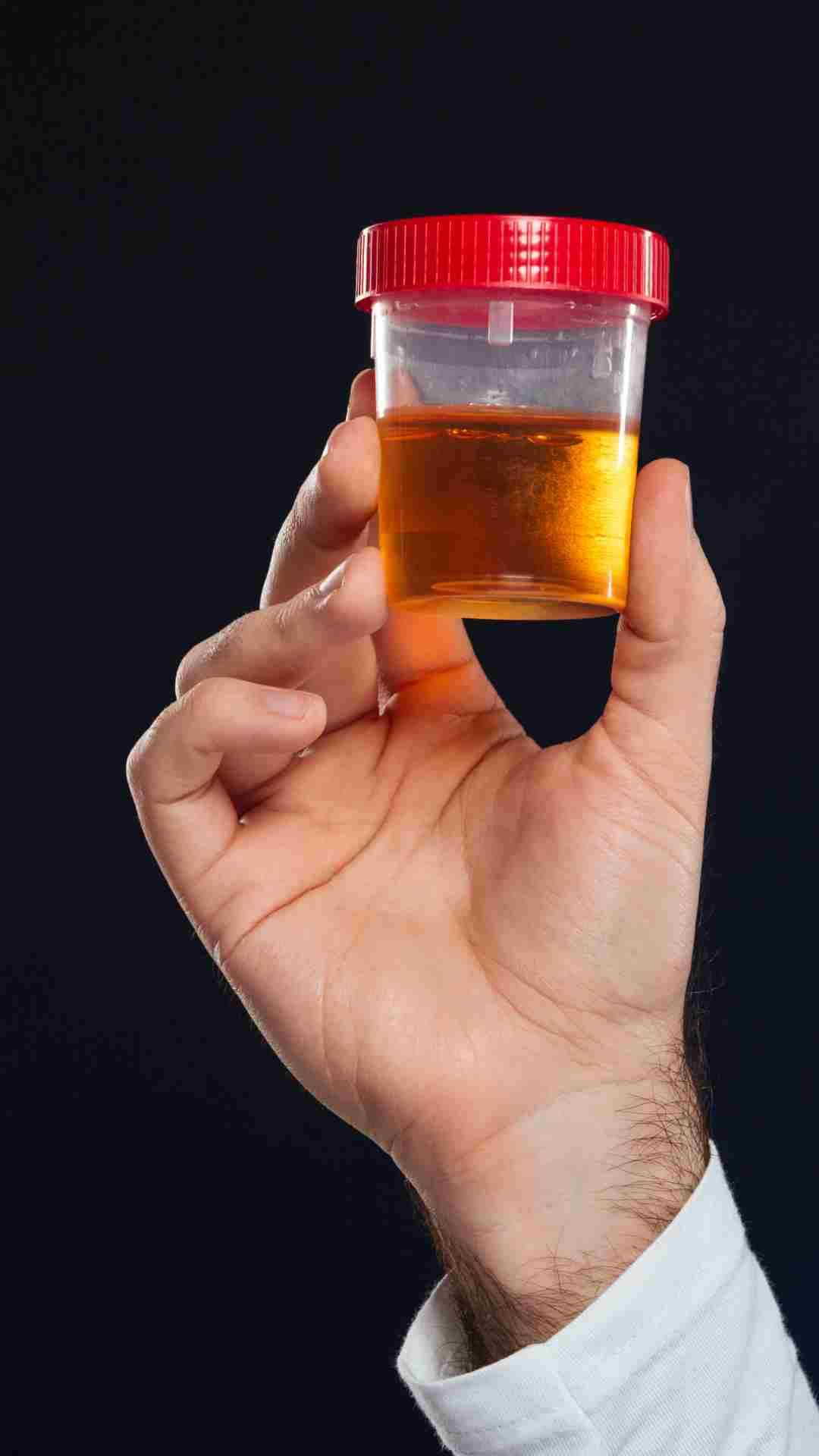 खुद की पेशाब पीना कितना खतरनाक?