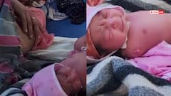 Watch: कुदरत का ये कैसा न्याय? बिना हाथों के पैदा हुई बच्ची, मासूम का वीडियो देख नम हो जाएंगी आखें!