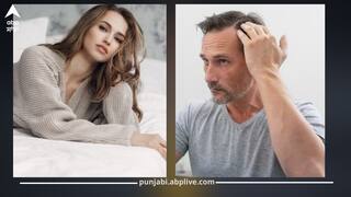 ਸਫੇਦ ਵਾਲਾਂ ਤੋਂ ਪਰੇਸ਼ਾਨ? ਡਾਕਟਰ ਨੇ ਦਿੱਤੀ ਇਸ ਚੀਜ਼ ਦੇ ਸੇਵਨ ਦੀ ਸਲਾਹ...ਕੁਦਰਤੀ ਤੌਰ 'ਤੇ ਹੇਅਰ ਹੋ ਜਾਣਗੇ ਕਾਲੇ