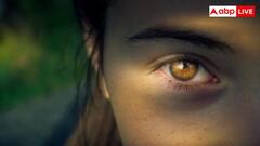 आंखों के नीचे डार्क सर्कल्स क्यों होते हैं? जानिए कारण, इलाज और बचाव के तरीके