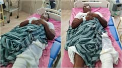 வலது காலுக்கு பதில் இடது காலில் ஆபரேஷன்: அரசு மருத்துவமனையின் அவலம் - நடந்தது என்ன?