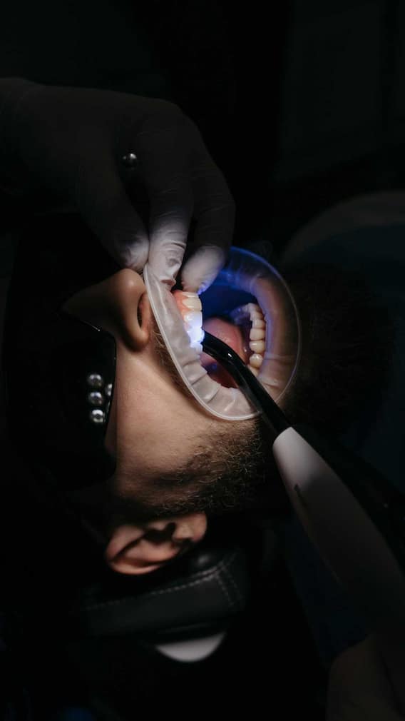 दांत में लग गए कीड़े तो ये देसी नुस्खे आएंगे काम