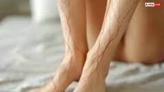 Health : પગ પર જો આ સમસ્યા અનુભવાય તો સાવધાન, પહેલા કરાવો બ્લડટેસ્ટ આ બીમારીના હોઇ શકે છે સંકેત