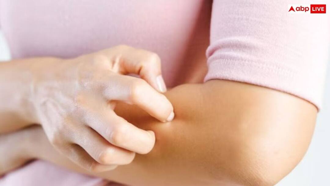 Frequent itching in the body is a symptom of kidney failure. સ્કિન પર જો વારંવાર આ લક્ષણો અનુભવાય તો સાવધાન, આ બીમારીના છે સંકેત