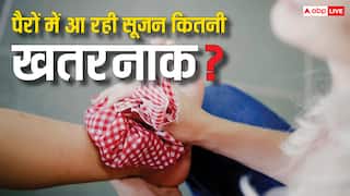 पैरों में लगातार आ रही है सूजन तो हो जाएं सावधान, हो सकती है ये बीमारी