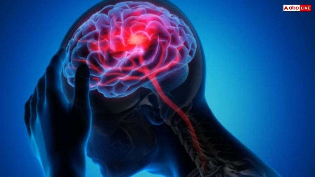 Stroke: பக்கவாதம் அறிகுறிகள்: 4.5 மணி நேரத்தில் உயிர் காக்கும் சிகிச்சை- ஸ்ட்ரோக்கை வெல்வது எப்படி? மருத்துவர் அறிவுறுத்தல் Stroke Symptoms: Life-saving Treatment in 4.5 Hours - How to Beat Stroke? Doctors Advice Stroke: பக்கவாதம் அறிகுறிகள்: 4.5 மணி நேரத்தில் உயிர் காக்கும் சிகிச்சை- ஸ்ட்ரோக்கை வெல்வது எப்படி? மருத்துவர் அறிவுறுத்தல்