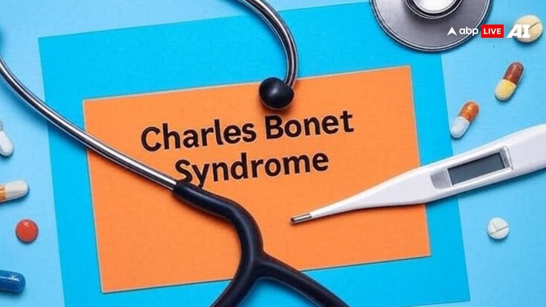 Understanding Charles Bonnet Syndrome — A Threat For The Older Generation charles bonnet syndrome CBS visual hallucinations in elderly vision loss mental health awareness Understanding Charles Bonnet Syndrome — A Threat For The Older Generation