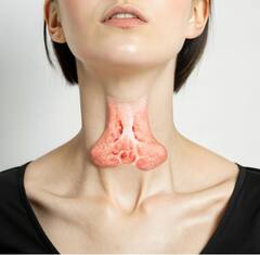 ਥਾਇਰਾਇਡ ਦੇ ਮਰੀਜ਼ ਨਾ ਖਾਣ ਇਹ ਚੀਜ਼ਾਂ; ਅੱਜ ਹੀ ਆਪਣੀ ਡਾਈਟ 'ਚ ਕਰੋ ਬਾਹਰ