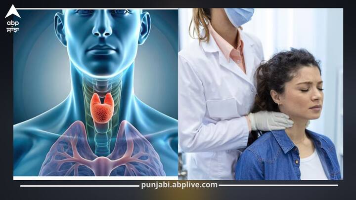 ਅੱਜਕੱਲ੍ਹ ਥਾਇਰਾਇਡ ਦੇ ਮਰੀਜ਼ ਤੇਜ਼ੀ ਨਾਲ ਵਧ ਰਹੇ ਹਨ। ਥਾਇਰਾਇਡ ਗਲੈਂਡ ਸਰੀਰ ਵਿੱਚ ਹਾਰਮੋਨ ਬਣਾਉਣ ਦਾ ਕੰਮ ਕਰਦਾ ਹੈ। ਜਦੋਂ ਇਹ ਗਲੈਂਡ ਠੀਕ ਤਰੀਕੇ ਨਾਲ ਕੰਮ ਨਹੀਂ ਕਰਦਾ ਤਾਂ ਸਰੀਰ ਵਿੱਚ ਬਹੁਤ ਤਕਲੀਫਾਂ ਆਉਂਦੀਆਂ ਹਨ...