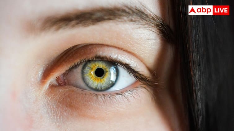 What causes eyelash dandruff and how to get rid of it naturally आंखों की खूबसूरती नहीं, सेहत भी बिगाड़ सकता है पलकों का डैंड्रफ– जानिए कारण, लक्षण और बचाव के उपाय