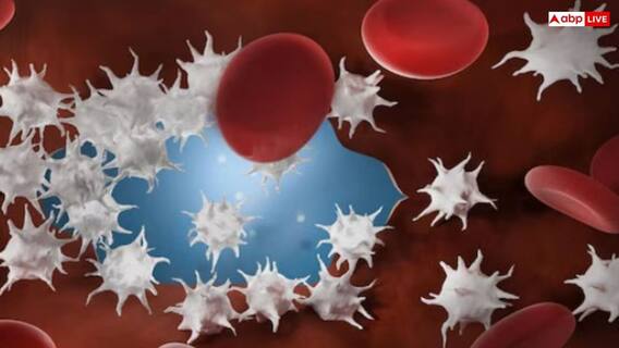 प्लेटलेट्स बढ़ाने के आसान और असरदार तरीके, जल्द से जल्द कैसे करें ठीक