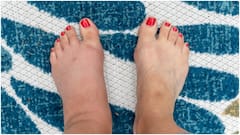 పాదాల వాపును తేలిగ్గా తీసుకోకండి.. ఈ లక్షణాలు కనిపిస్తే ప్రమాదమే, జాగ్రత్త